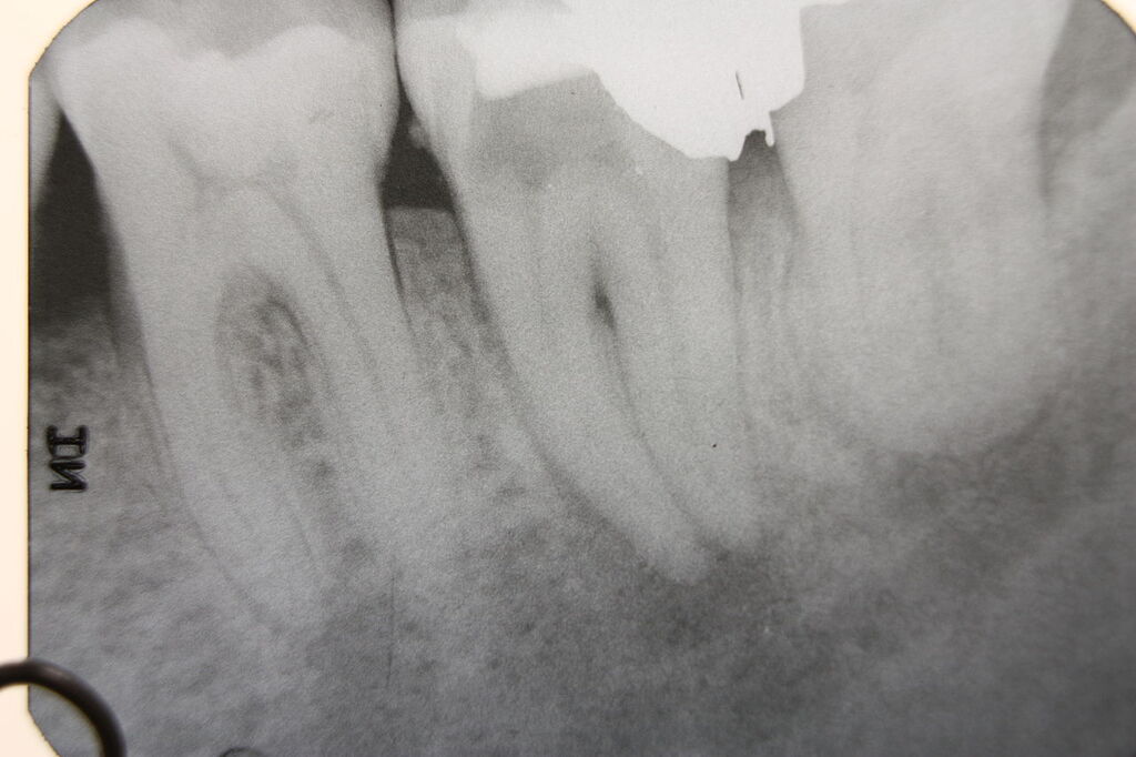 Are Dental and Medical Xrays for Kids Safe?