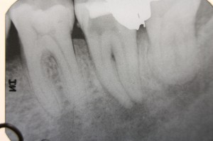 Image of Dental X-ray