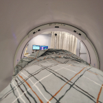 My Own Experience with Radiation Therapy