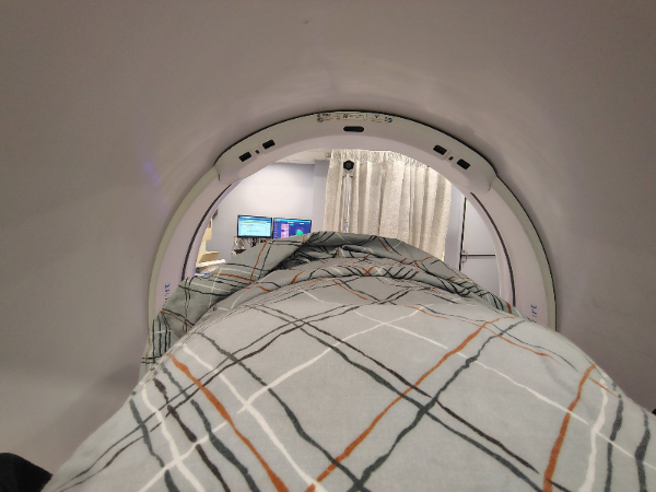 My Own Experience with Radiation Therapy